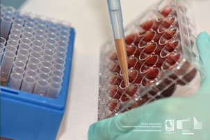 Collection of plasma